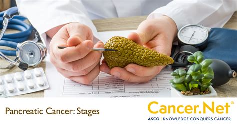 Now, that's not the same as <b>Stage</b> 4 <b>pancreatic</b> <b>cancer</b>. . End stage pancreatic cancer life expectancy